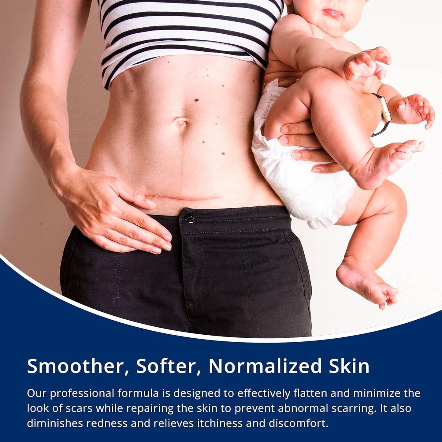 100% Silicone Scar Gel Scar Cream - Advanced Scar Gel for Old and New Scars ๐ All In One Marketplace Canada