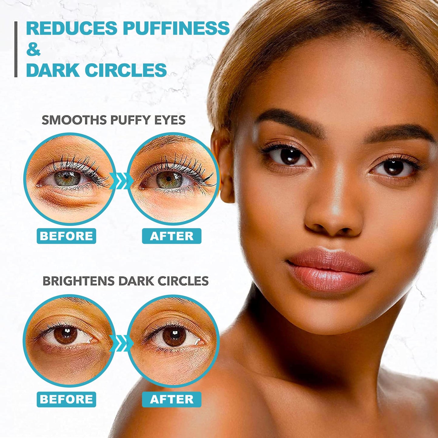 Under Eye Patches For Puffy Eyes And Dark Circles - Retinol Collagen Under Eye Masks - Reduce Wrinkles & Bags - Skin Treatment Pads - Anti Aging Moisturizer Mask For Women Gift - 60 Gel Pads ๐ All In One Marketplace Canada