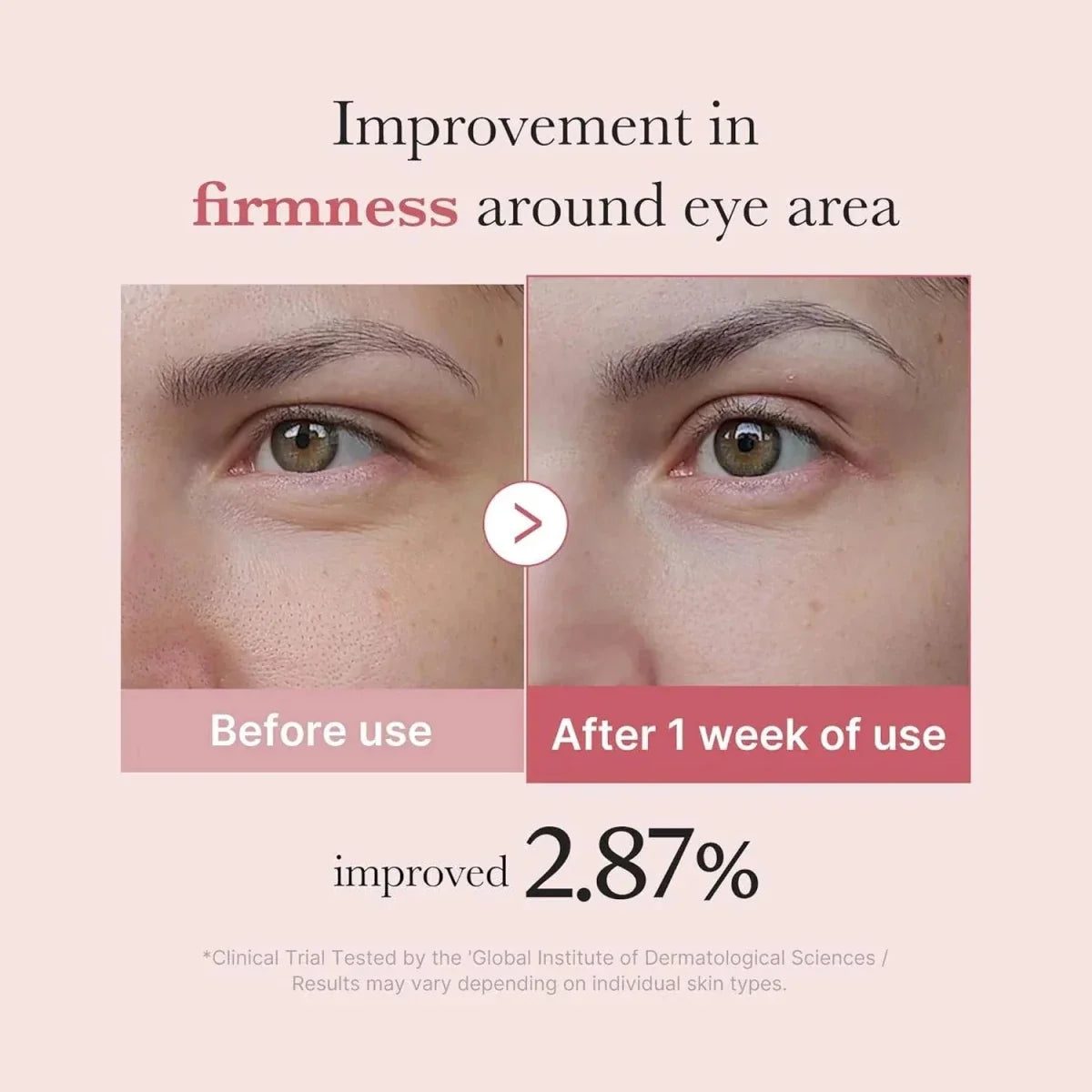 Medicube PDRN Pink Peptide Eye Serum 30ml