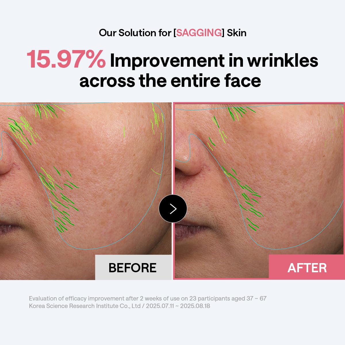 MEDIHEAL Collagen Firming Toner Pad – Korean Skincare, 98% Vegan Collagen with Retinol & 7 Peptides, Firming, Plumping & Wrinkle Care, Micro-Hole Fabric, 100 Pads 🍁 All In One Marketplace Canada