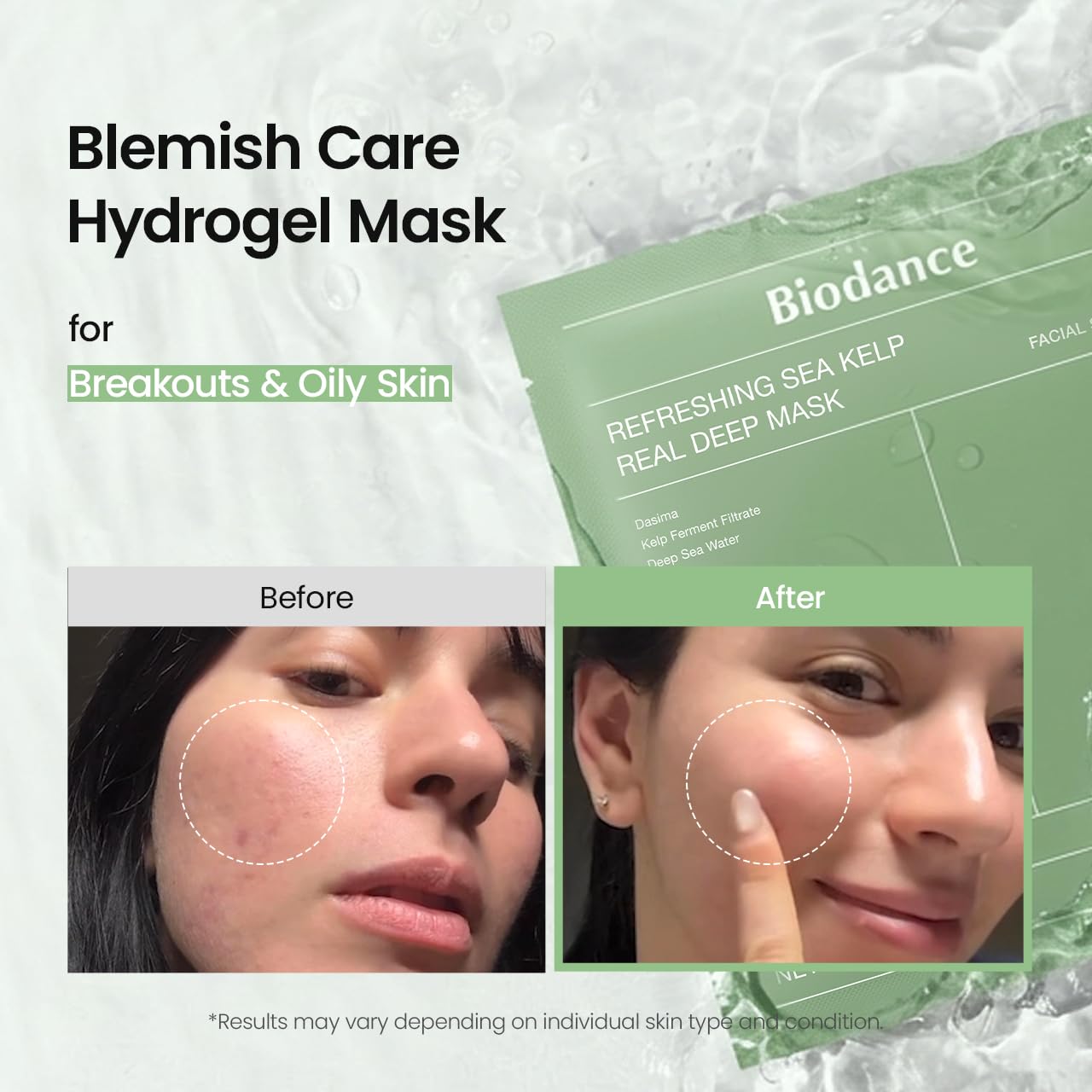 BIODANCE Refreshing Sea kelp Real Deep Mask, Hydrogel Mask, Calming, Oil & Sebum Control, Blemish Care, Korean Skincare, 1.19oz(34g) x 4eaBIODANCE Refreshing Sea kelp Real Deep Mask, Hydrogel Mask, Calming, Oil & Sebum Control, Blemish Care, Korean Skinca