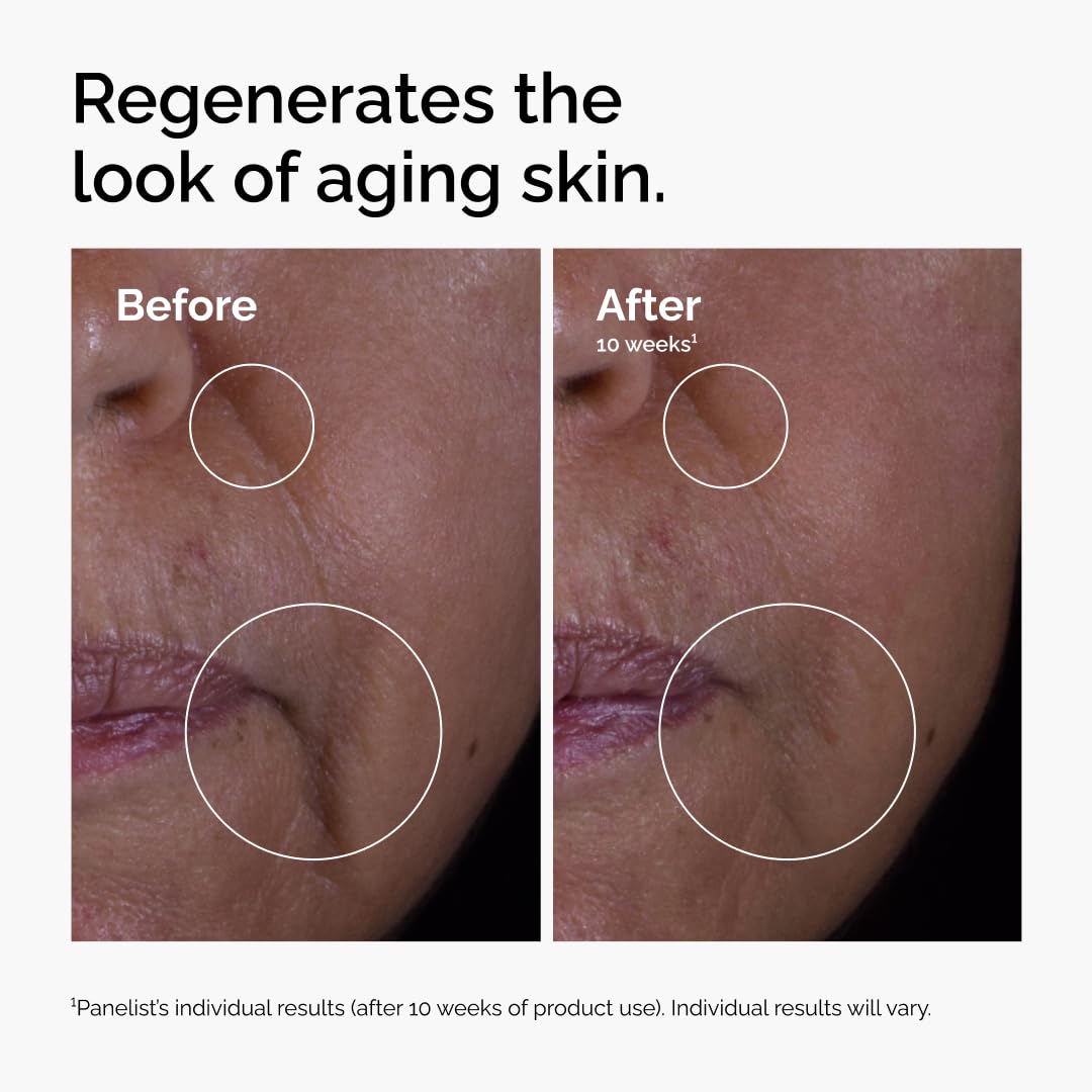 The Ordinary GF 15% Solution, Anti-Aging Formula for Visible Skin & Wrinkle Repair, 30 ml 🍁 All In One Marketplace Canada