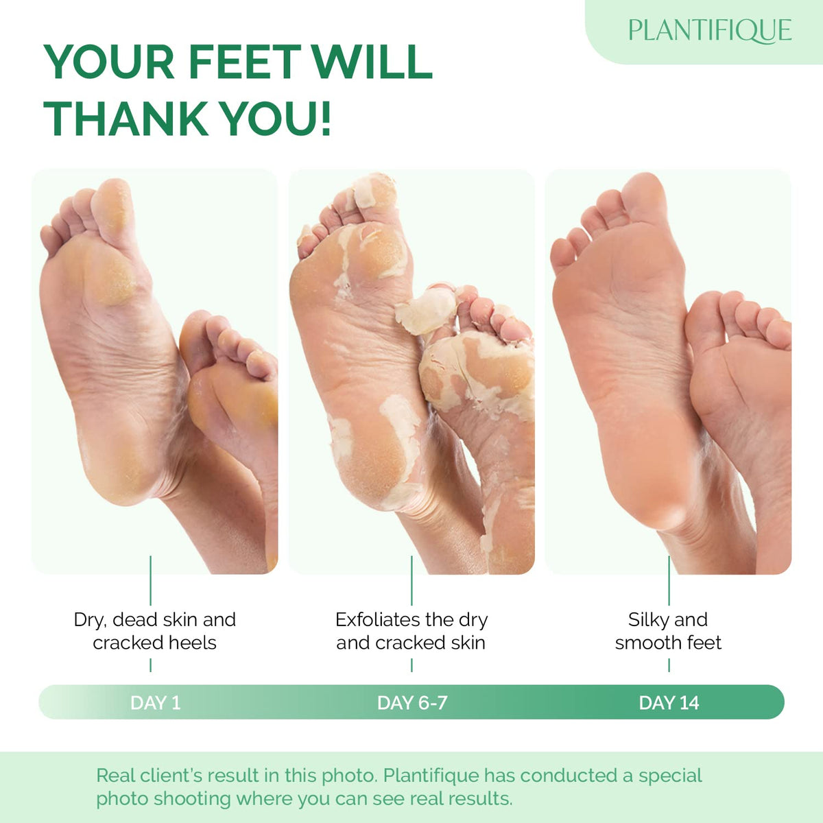 PLANTIFIQUE Foot Peel Mask Dermatologically Tested - 2 Pairs Peach Exfoliating Mask for Dry Cracked Feet - Masque Pied Peeling - Foot Care for Soft Baby Feet 🍁 All In One Marketplace Canada