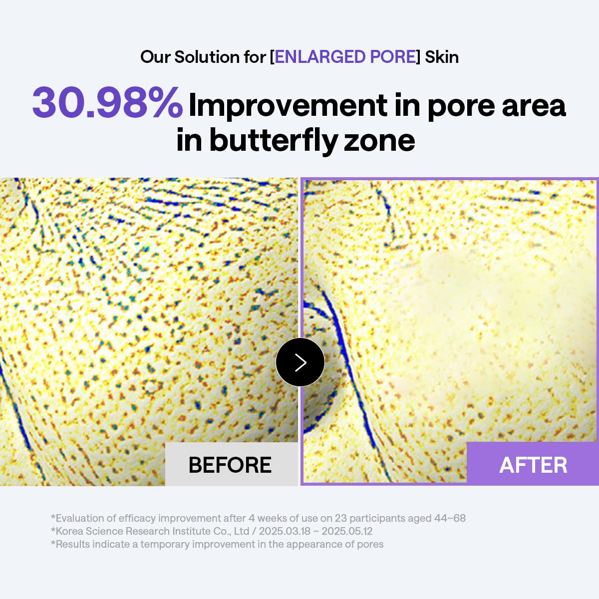 MEDIHEAL PDRN Lifting Toner Pads – Pore Tightening with Plant-Based PDRN, Peptide, Glutathione & PHA, Pore Care, Firming & Wrinkle Care, Stretchy Lifting Fabric, Korean Skin Care, 100 Pads 🍁 All In One Marketplace Canada