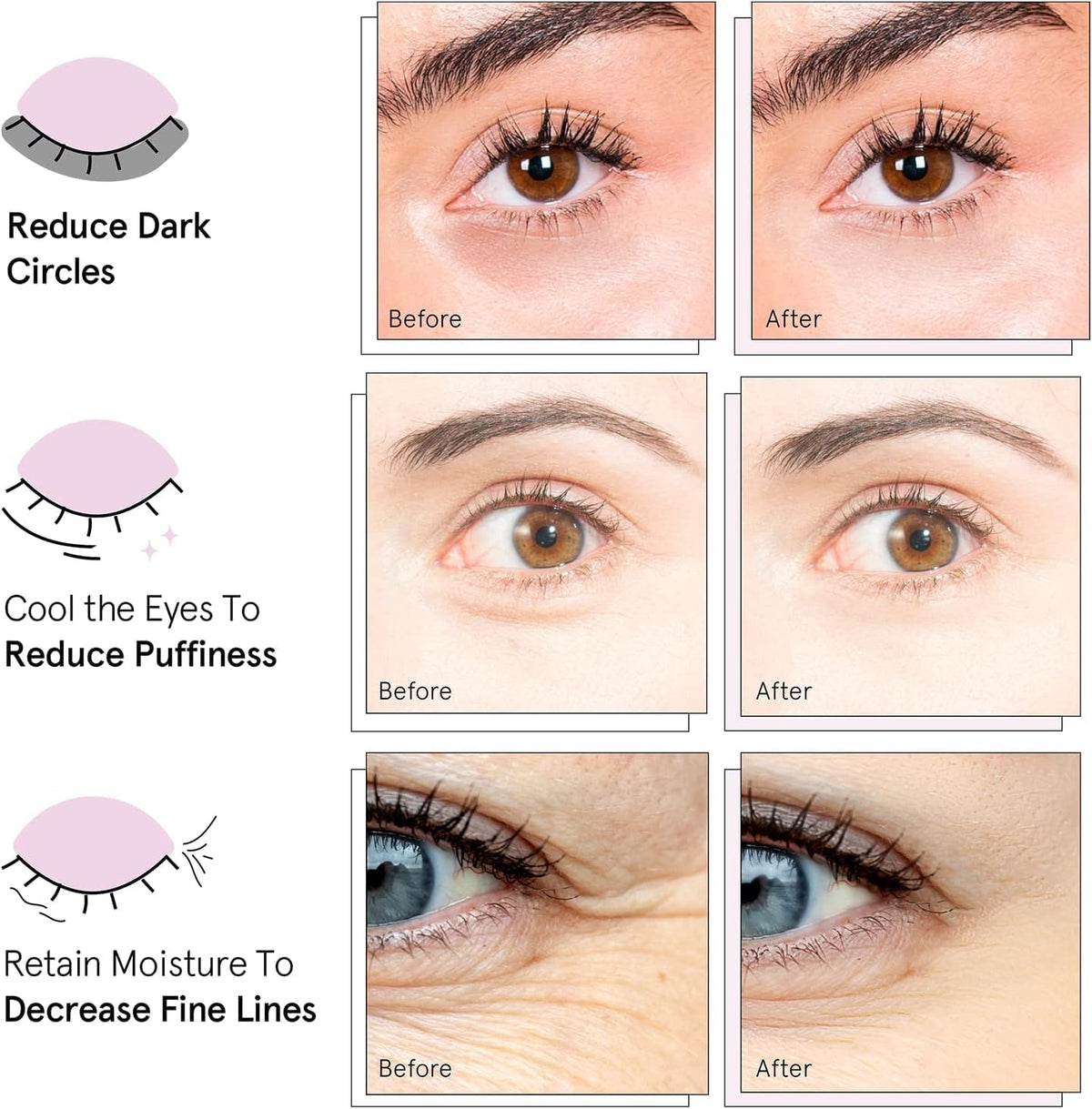 grace & stella Award Winning Under Eye Mask - Gifts for Her - Birthday Gifts for Women - Gel Eye Patches for Dark Circles, Puffy Eyes, Wrinkles, Undereye Bags - Self Care Gifts (24 Pairs, Pink) 🍁 All In One Marketplace Canada