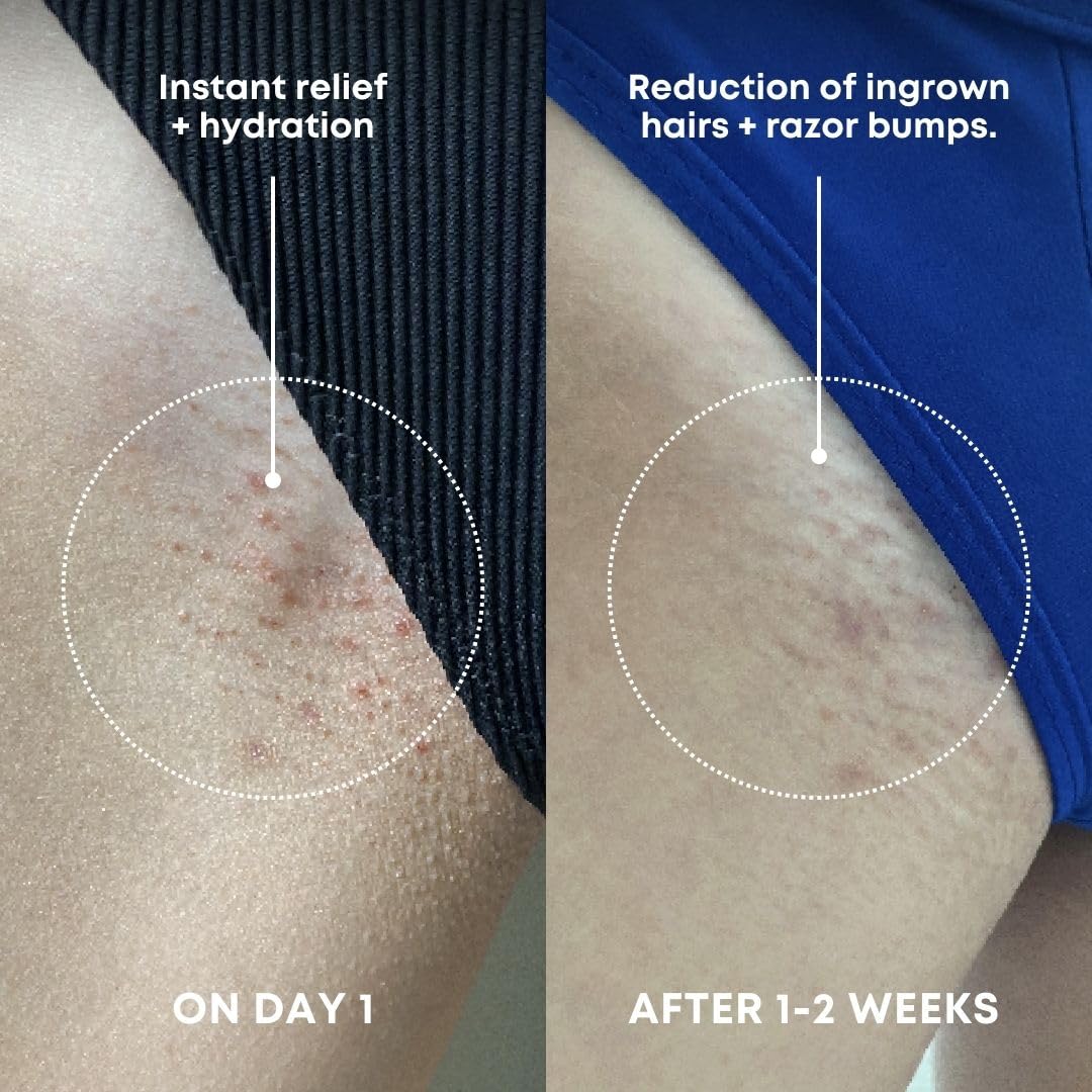 Bushbalm Ingrown Hair Exfoliating Scrub - Reduces Appearance of Ingrown Hairs and Razor Bumps, Soothes Skin and Post-Shave Redness - Nude, 236 ml 🍁 All In One Marketplace Canada