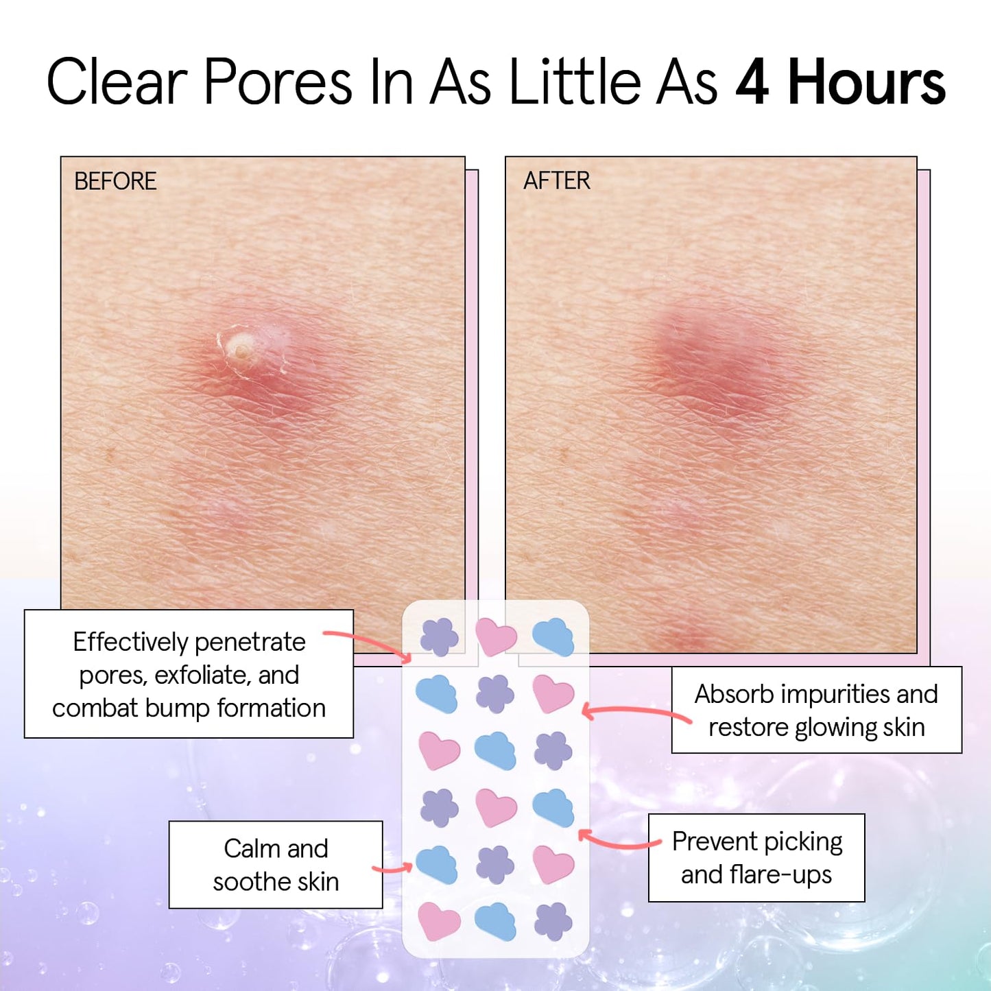 grace & stella Award Winning Skin Rescue Covers with Hydrocolloid (Multishape, 72 Count) - With Salicylic Acid and Tea Tree for Absorbing Impurities - Dermatologist Tested Skin Care, Cruelty Free, Vegan 🍁 All In One Marketplace Canada