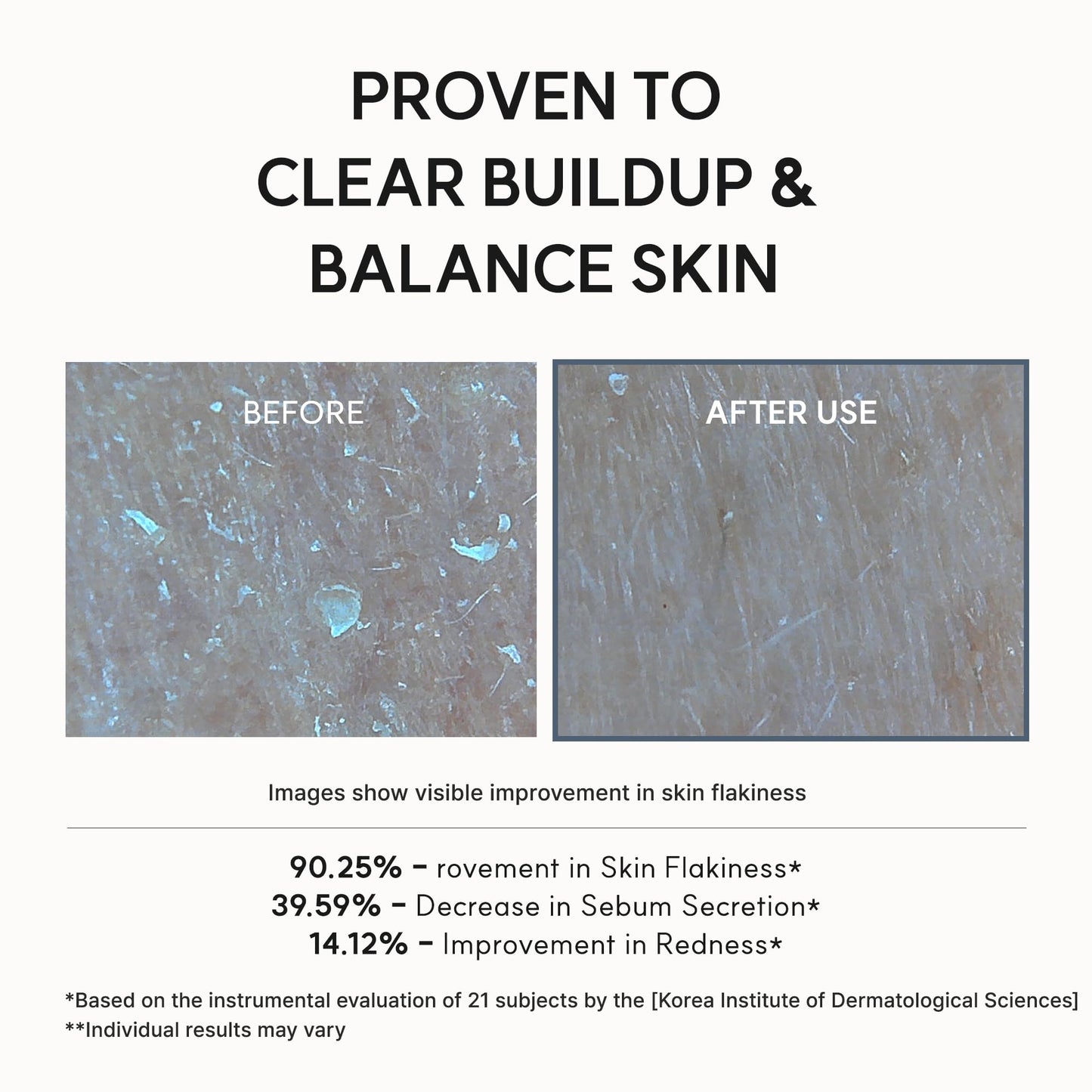 Arencia Eraser Serum Glycolic Acid Booster with AHA BHA, Exfoliating Face Serum for Acne-Prone Skin, Pore Care & Texture Refining, Lightweight Daily Skincare, 30 mL 🍁 All In One Marketplace Canada