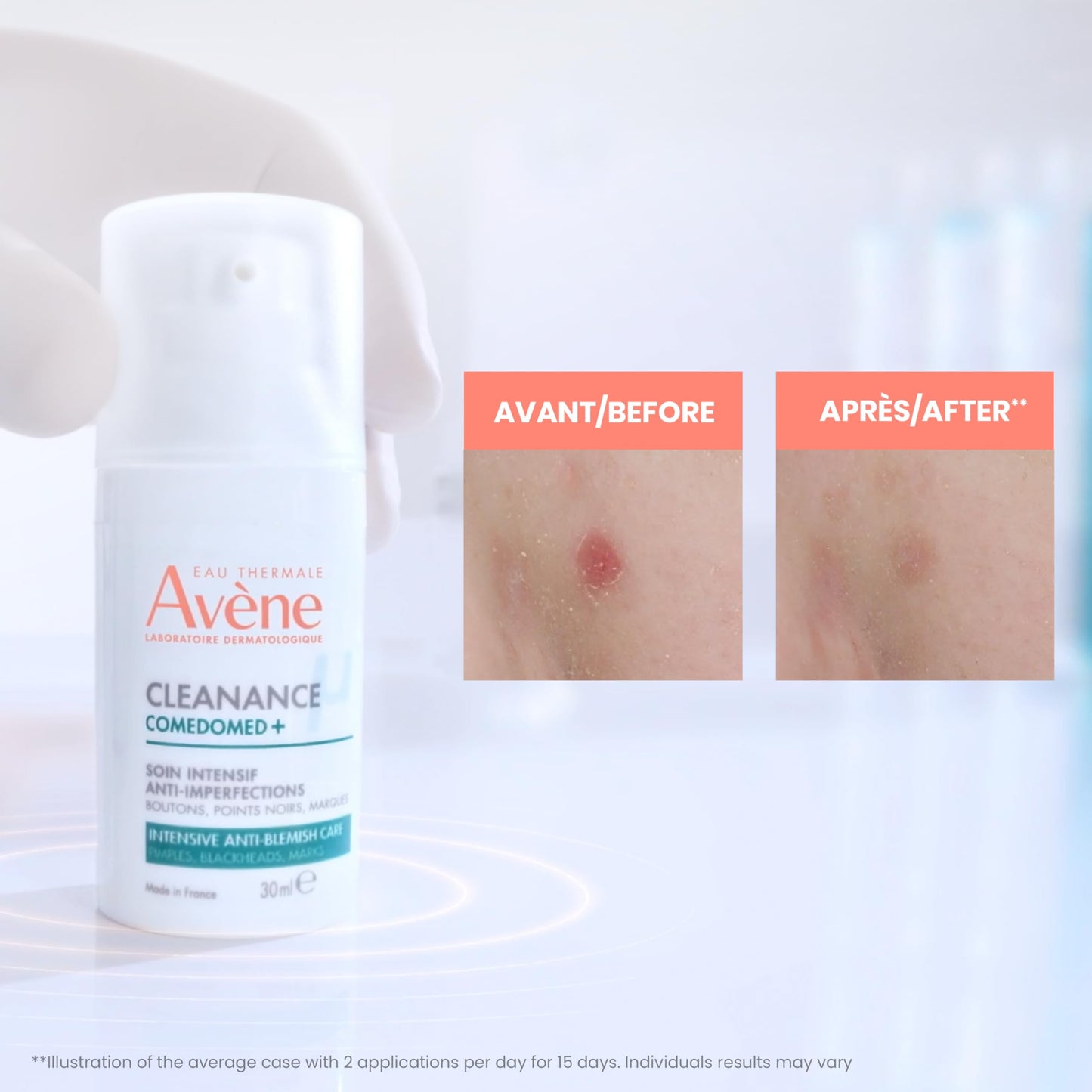 Eau Thermale Avene Cleanance Comedomed+ anti-blemish cream, niacinamide, 30 ml 🍁 All In One Marketplace Canada