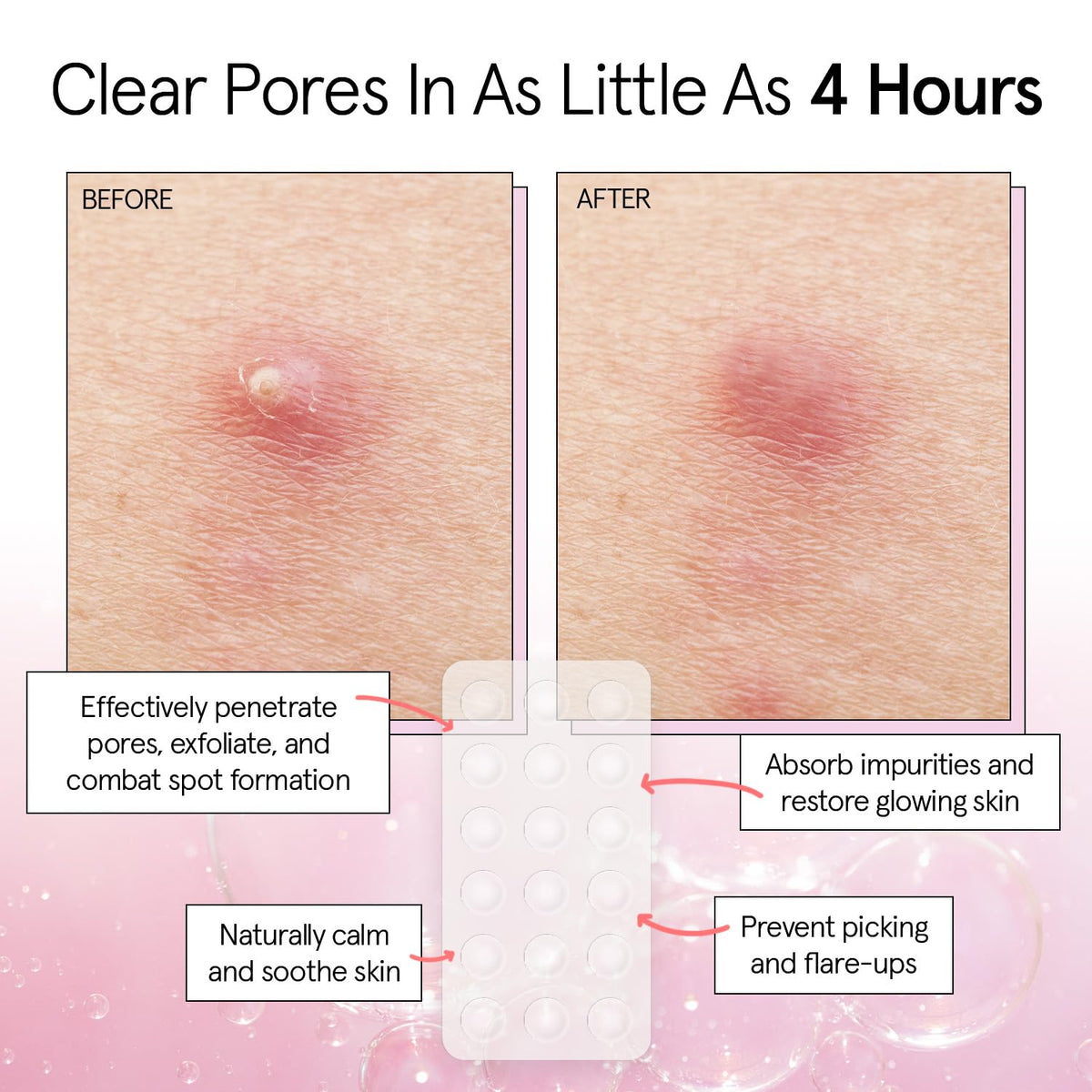 grace & stella Award Winning Invisible Skin Rescue Covers with Hydrocolloid (Round, 36 Count) - With Salicylic Acid and Tea Tree for Absorbing Impurities - Dermatologist Tested Skin Care, Cruelty Free, Vegan 🍁 All In One Marketplace Canada