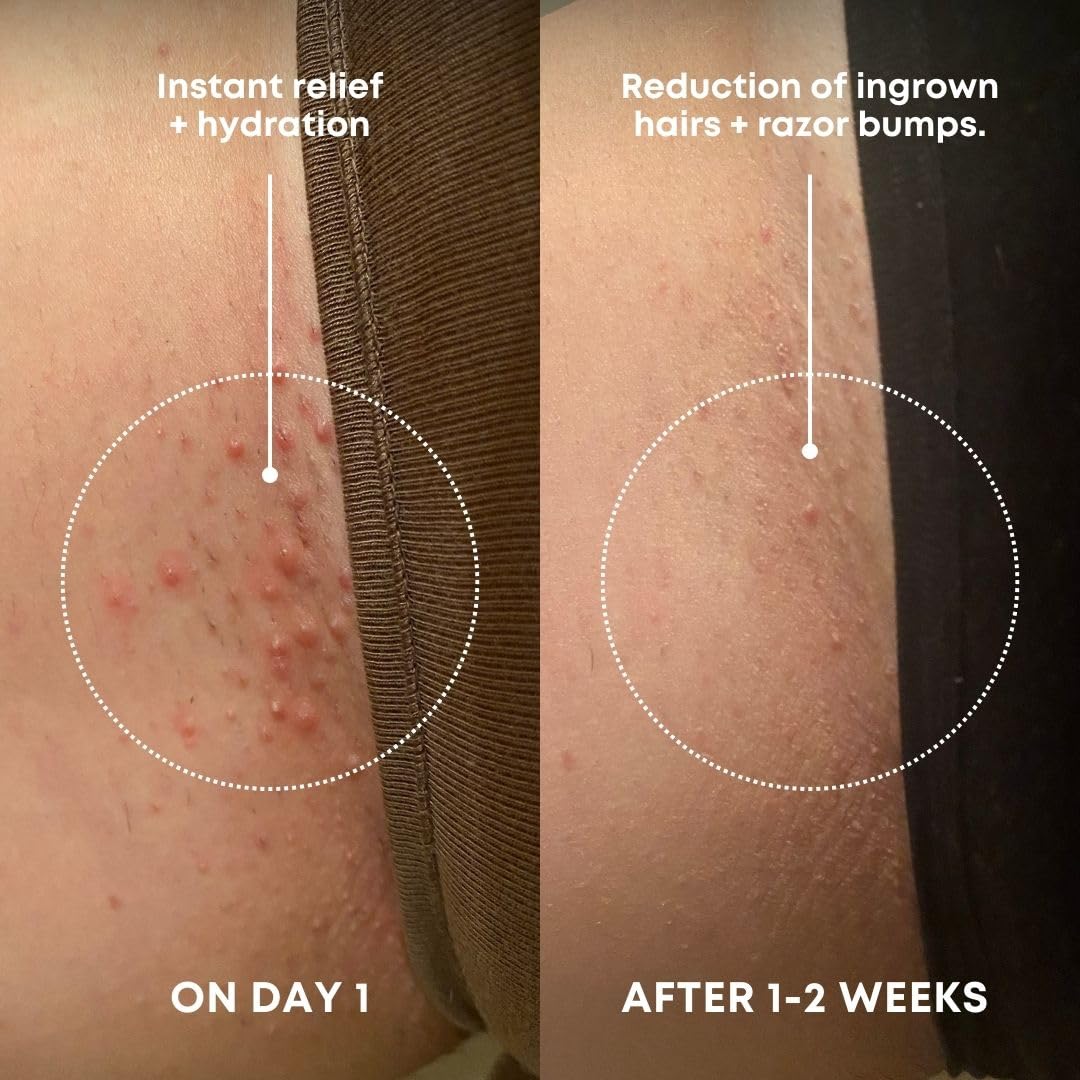 Bushbalm Ingrown Hair Exfoliating Scrub - Reduces Appearance of Ingrown Hairs and Razor Bumps, Soothes Skin and Post-Shave Redness - Nude, 236 ml 🍁 All In One Marketplace Canada