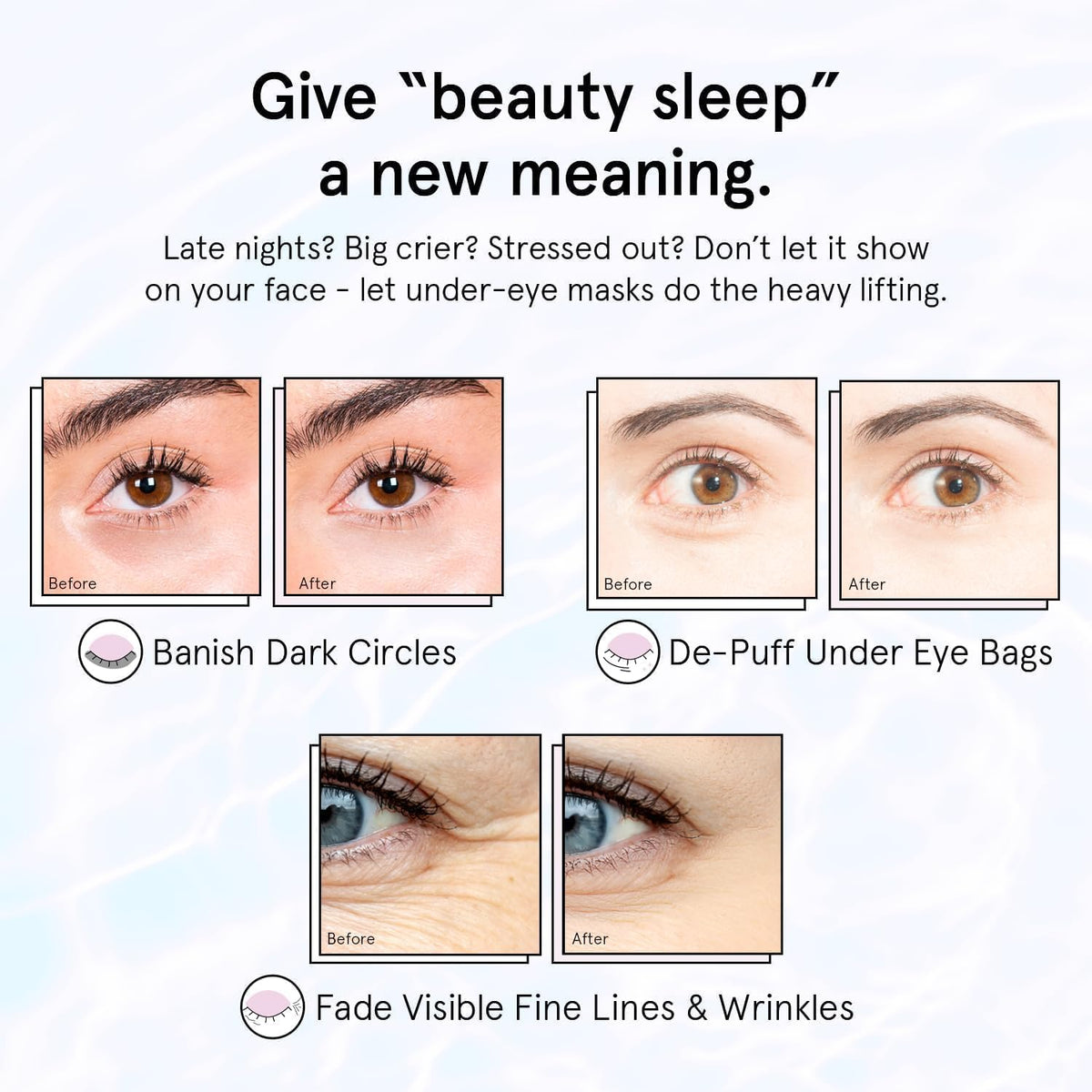 grace & stella Under Eye Masks With Retinol - Revitalizing Under Eye Patches for The Wrinkles & Dark Circles - Gel Eye Mask - Gifts for Mom, Teen Girl Gifts - Vegan, Cruelty-Free (24 Pairs) 🍁 All In One Marketplace Canada