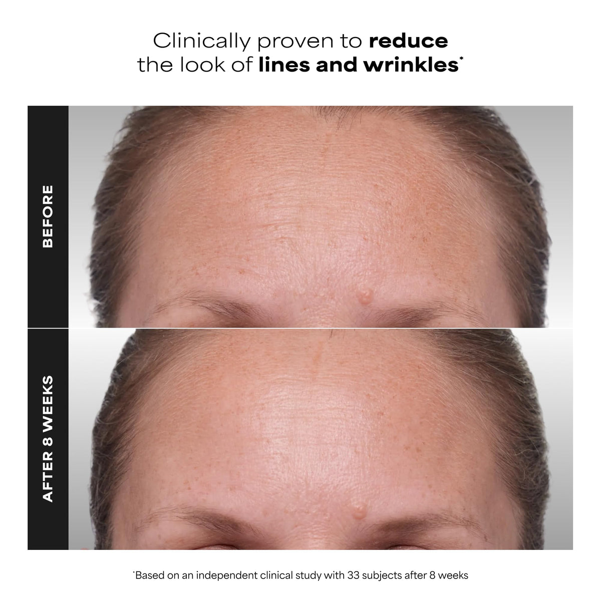 Paula's Choice CLINICAL 1% Retinol Treatment Cream with Peptides, Vitamin C & Licorice Extract, Anti-Aging Treatment for Wrinkles & Loss of Firmness, Fragrance-Free, 30 mL 🍁 All In One Marketplace Canada
