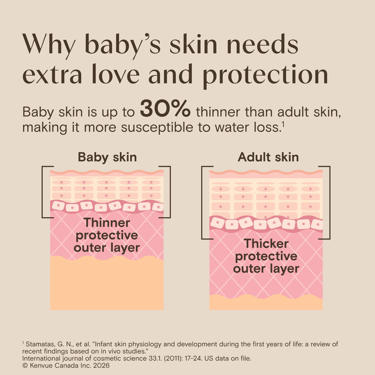 Aveeno Baby Eczema Care Daily Moisturizing Body Cream for Dry, Itchy Skin, Natural Colloidal Oat & Vitamin B5, Hypoallergenic & ph-Balanced, No Added Steroids, Phthalates, Parabens or Fragrance, 330mL 🍁 All In One Marketplace Canada