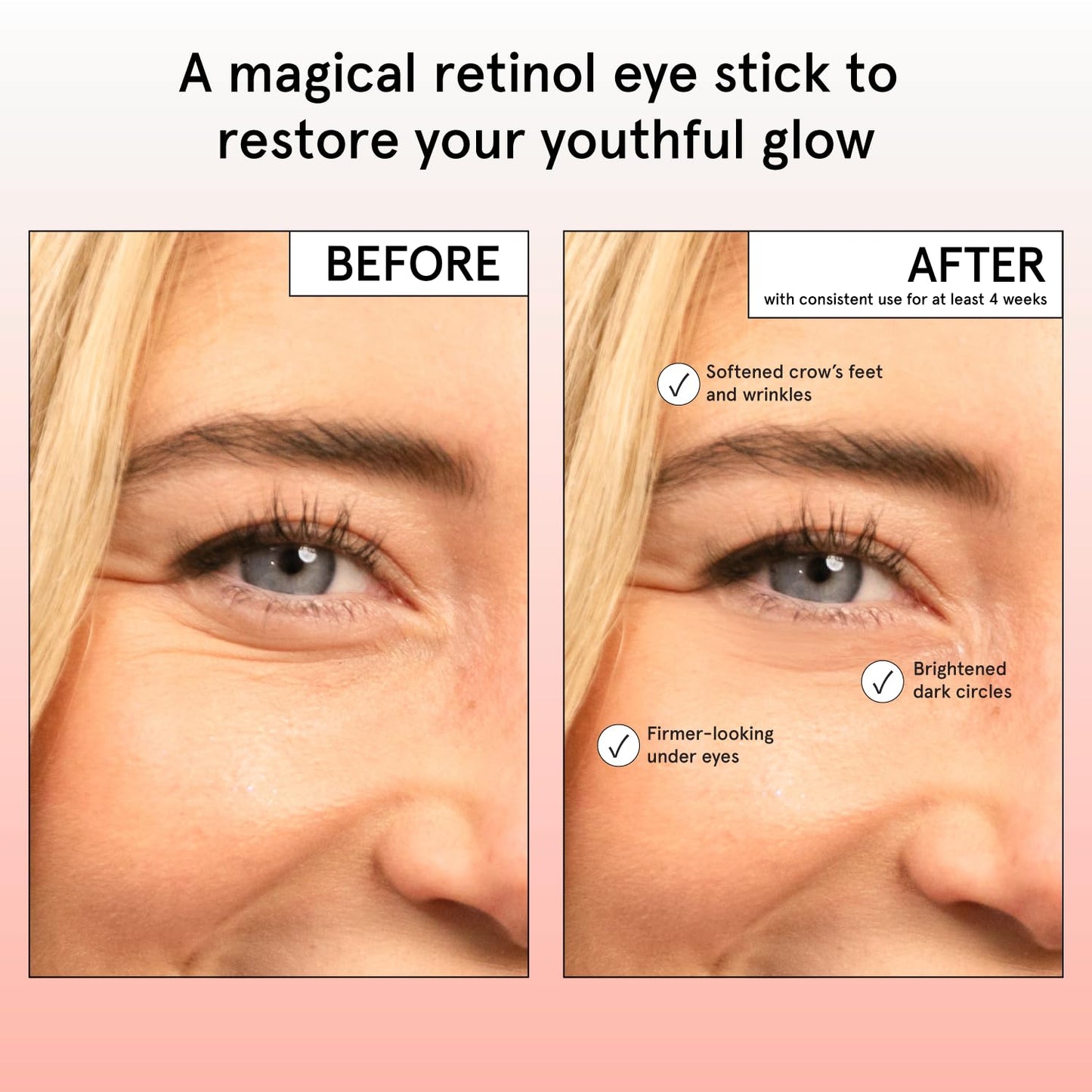 grace & stella Retinol & Caffeine Eye Cream Stick - Under Eye Cream for Dark Circles, Anti-Aging, Puffiness, Wrinkles, Undereye Bags - Brightener with Niacinamide - Vegan Skincare (0.13 oz/3.5 g) 🍁 All In One Marketplace Canada