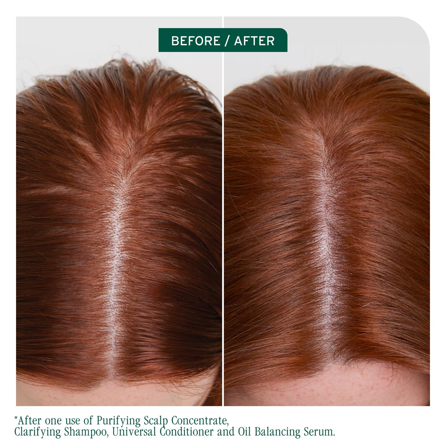 Biolage Clarifying Shampoo, Scalp Sync, Removes Residue, Buildup and Excess Oil, For Oily Hair & Scalp, Gently Exfoliates With Glycolic Acid, Paraben and Silicone Free, Vegan, Cruelty Free 🍁 All In One Marketplace Canada