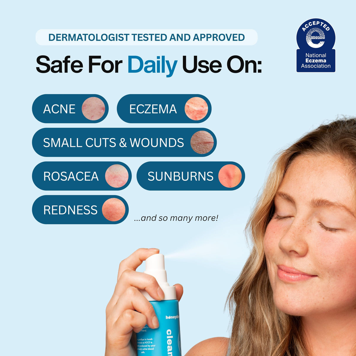 Hypochlorous Acid Spray – Dermatologist Tested HOCl Facial Cleanser for Sensitive, Acne-Prone & Irritated Skin – Soothes Redness, Eczema, Rashes & Itching – Skin Repair Spray, 200 mL - Honeydew Labs 🍁 All In One Marketplace Canada