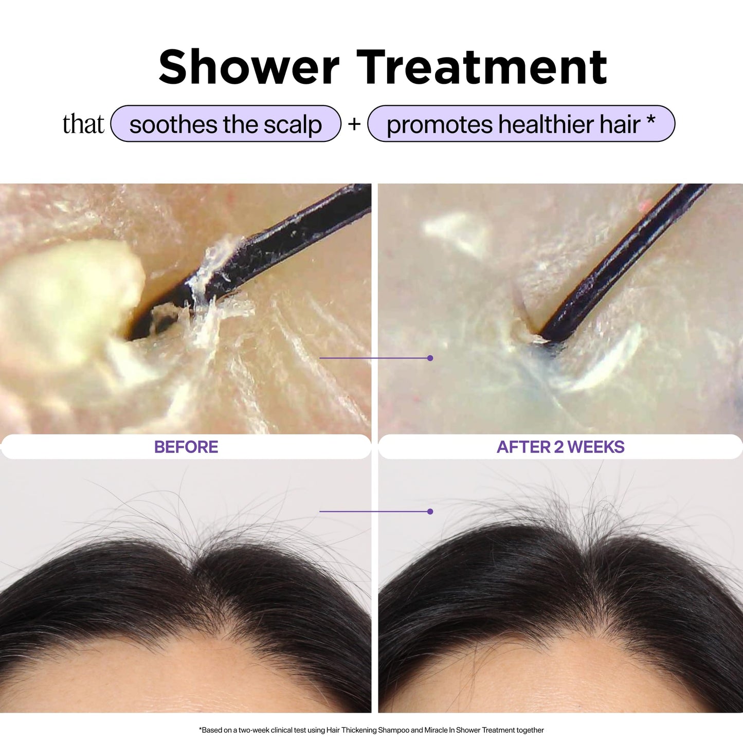 Dr. Groot Miracle in Shower Treatment, Korean Hair Care, 5 Seconds to Smooth Hair, Rosemary Oil for Healthier-Looking Hair, Hair Rinse, Moisturizing Treatment, Scalp Revitalizing Solution 🍁 All In One Marketplace Canada