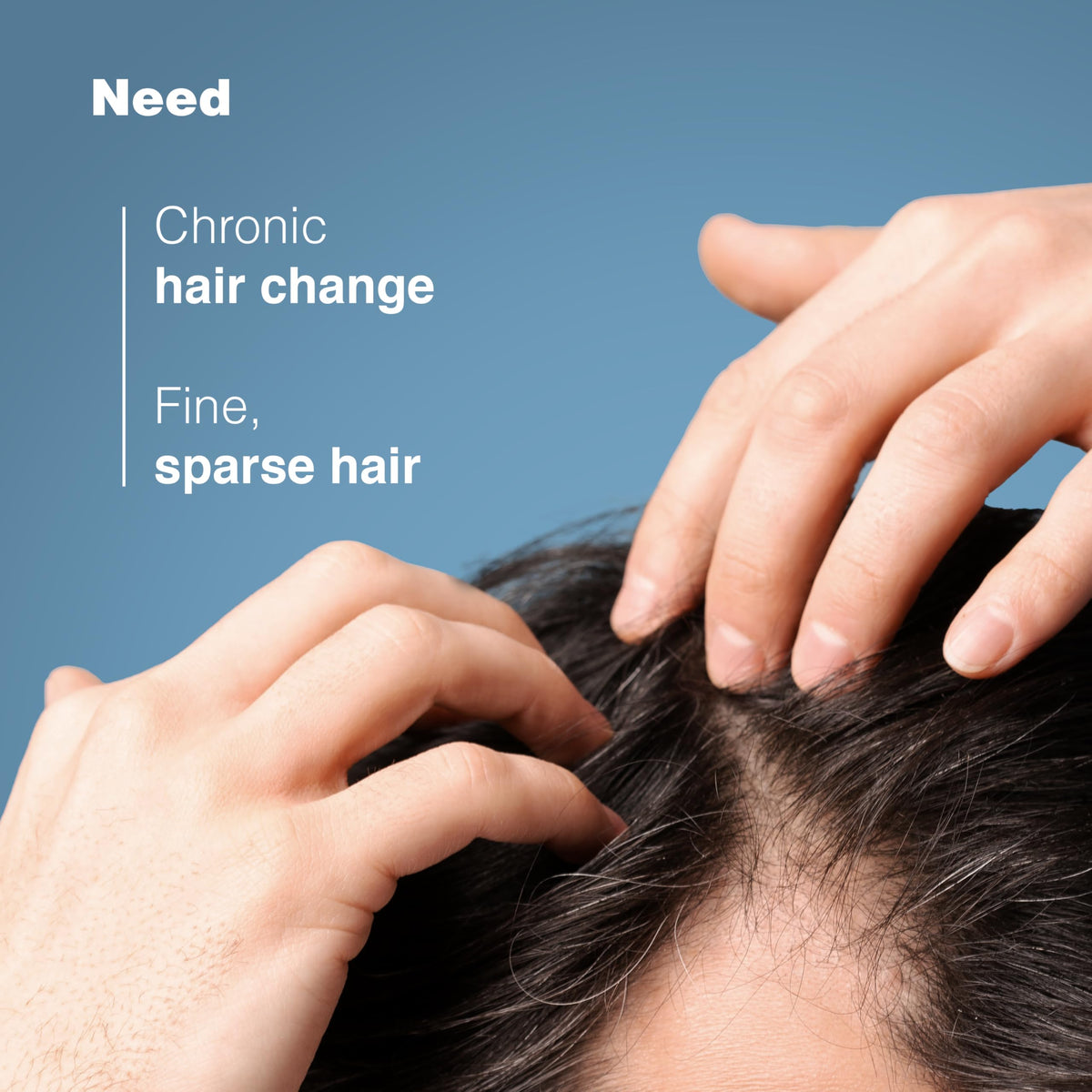 Ducray Anaphase+ hair loss & density shampoo for thinning hair, 400ml 🍁 All In One Marketplace Canada
