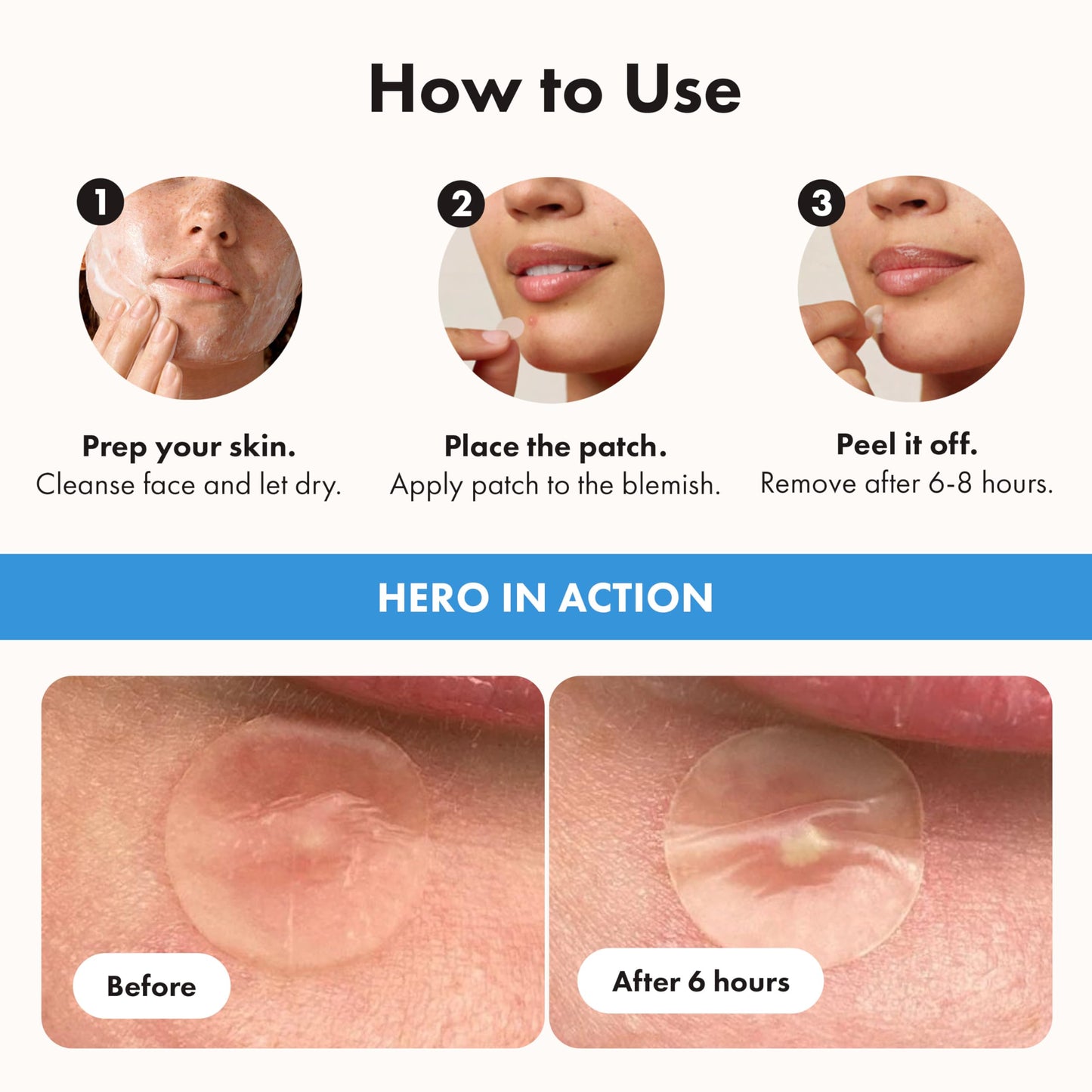 Hero Cosmetics Mighty Patch Invisible+ – Barely-there Hydrocolloid Patch for Pimples on the Face, Day-time Patches for Sensitive Skin, 39 Count 🍁 All In One Marketplace Canada