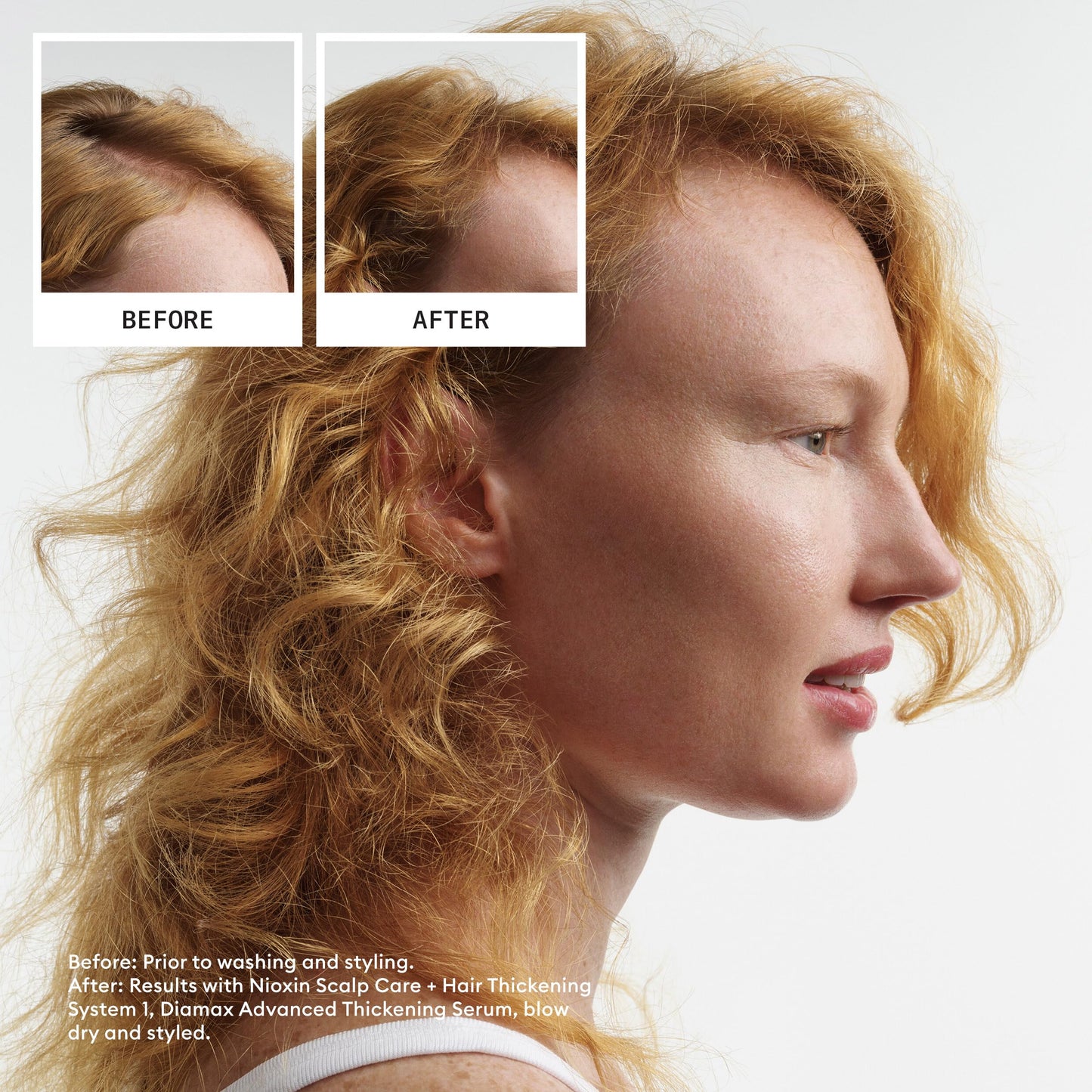 Nioxin System 4 Scalp + Hair Conditioner - Hair Thickening Conditioner for Damaged Hair with Progressed Thinning, 16.9 fl oz (Packaging May Vary) 🍁 All In One Marketplace Canada