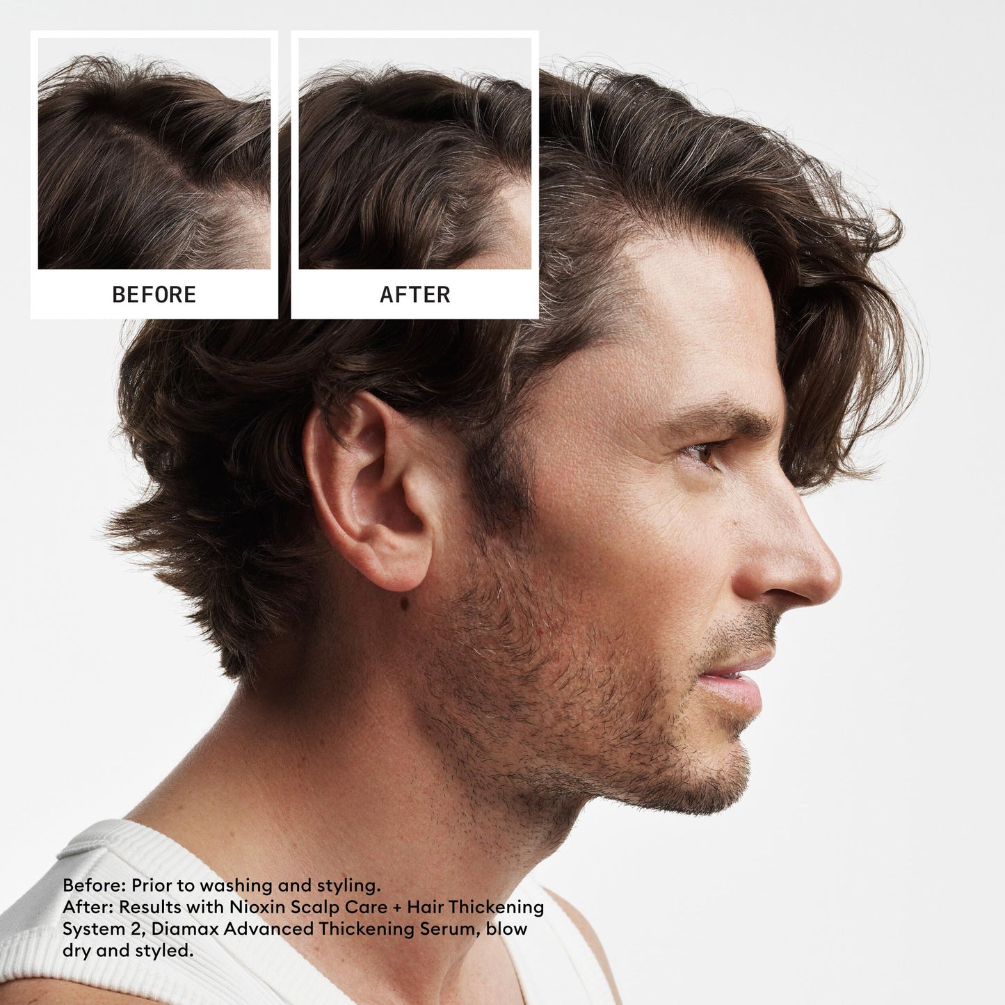 Nioxin Scalp + Hair Thickening System 2 Conditioner, For Natural Hair with Progressed Thinning, 16.9 fl oz (Packaging May Vary) 🍁 All In One Marketplace Canada