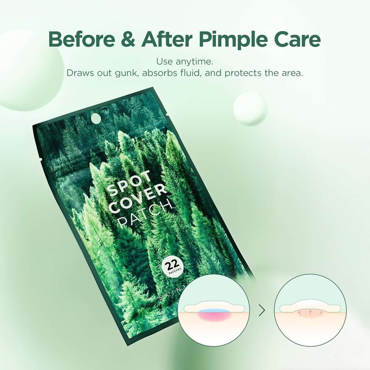 SKIN1004 Spot Cover Patch 22pcs